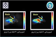 مسیر دارو رسانی به مغز ردیابی شد