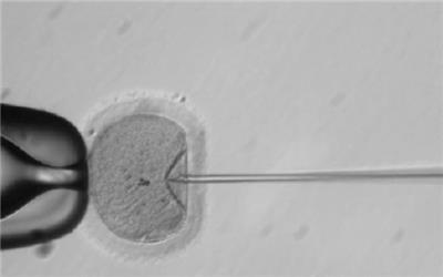 3ژن عامل ناباروری کشف شد/ جلوگیری از انتقال به نسل های بعد